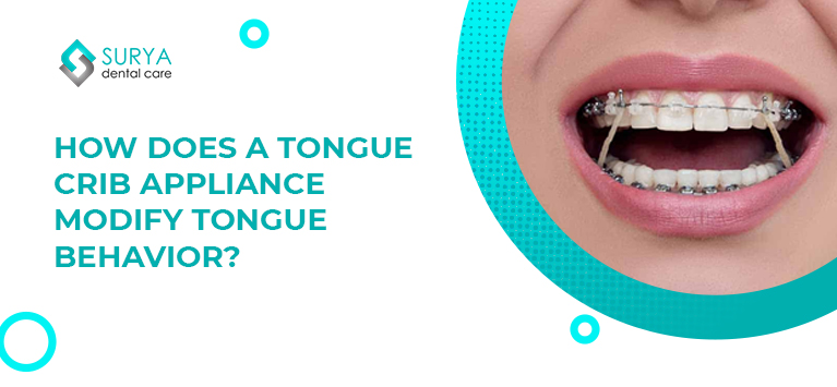 Benefits of Using a Tongue Thrust Appliance