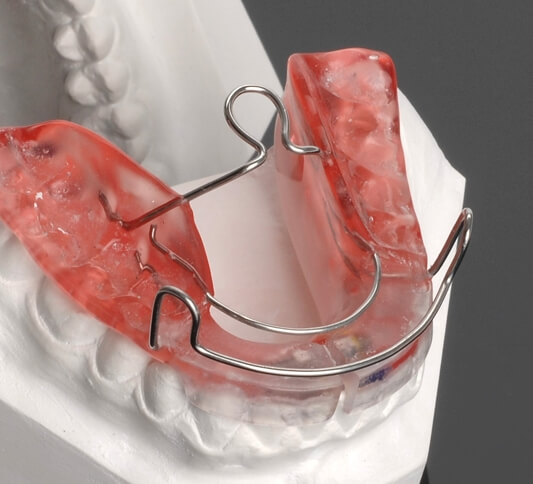 Exploring the Efficacy of the Bionator Appliance in Orthodontics