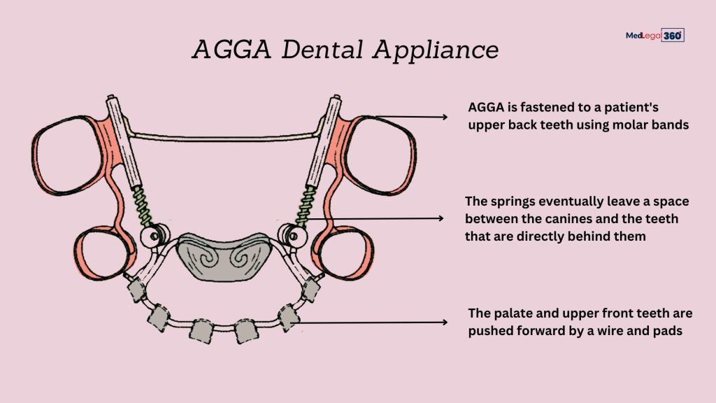 Improving Dental Health with the Agga Appliance