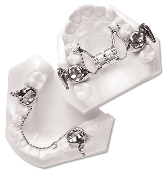 Mara Orthodontic Appliance: An Effective Solution for Orthodontic Treatment