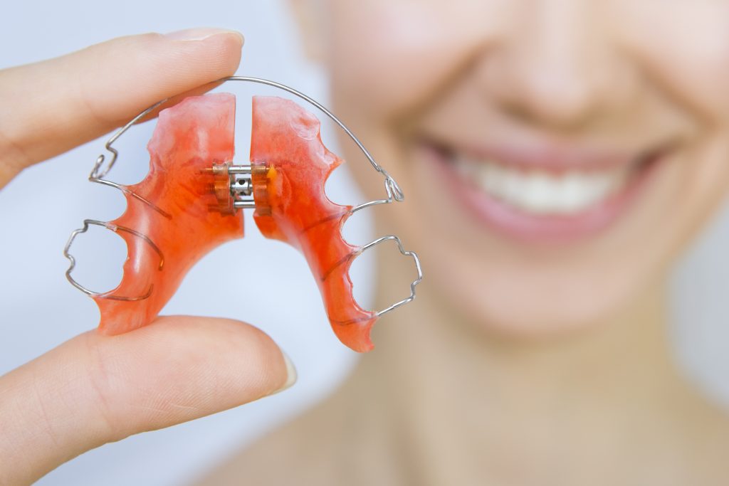 Orthodontic Treatment for Overbite Correction
