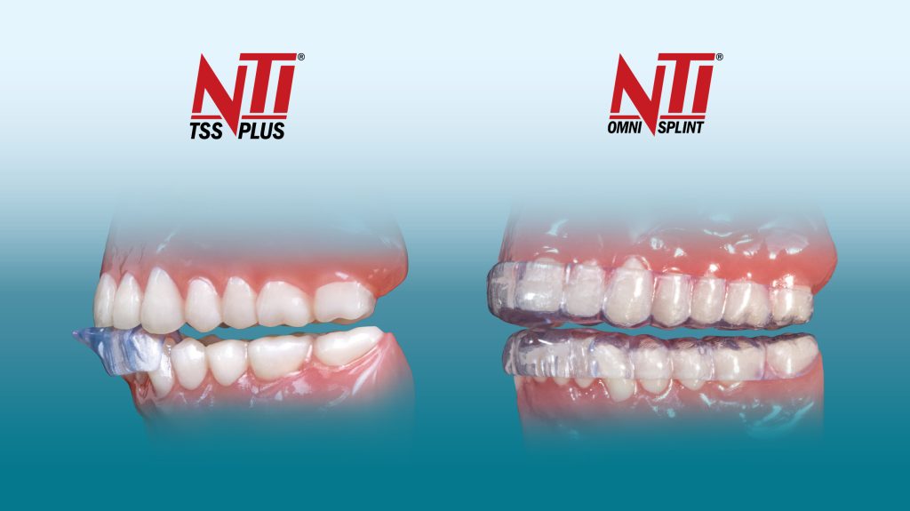 The Benefits of an NTI Appliance