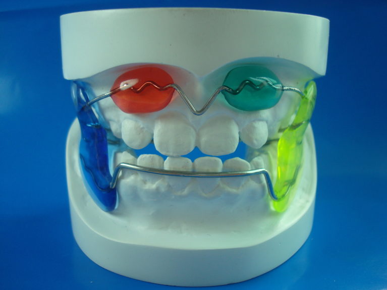 The Efficacy of the Frankel Appliance in Orthodontic Treatment
