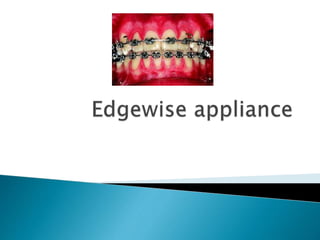 What is an Edgewise Appliance?