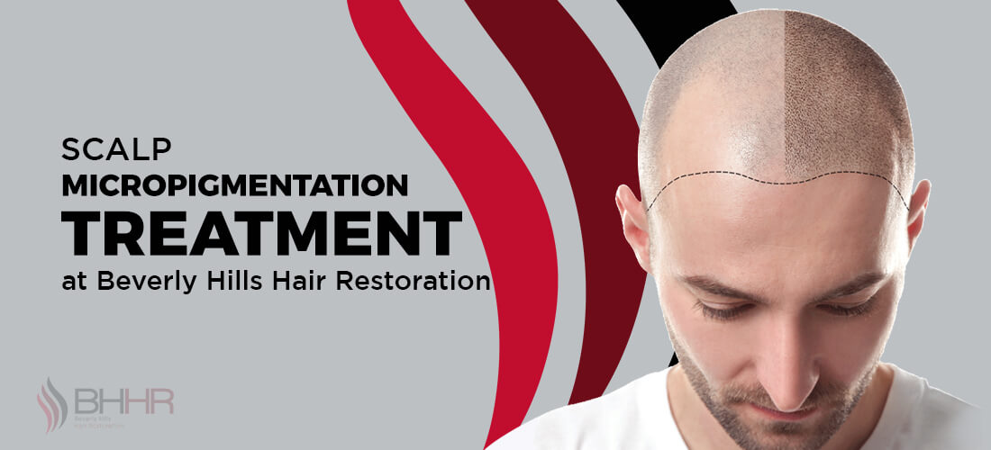 Advanced Hair Restoration Beverly Hills Reviews