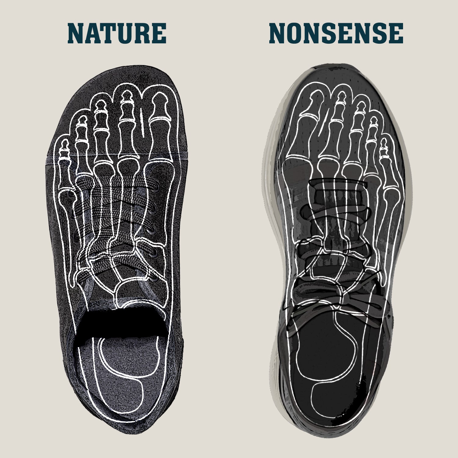 Naboso Insoles Review
