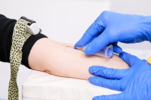Needle Guide: Excelling in Medical Procedures