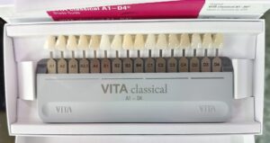 Vita Shade Guide: Navigating Tooth Shade Selection for Dentistry